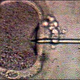 Image for article titled American Egg Donors Report Negative Post-Procedure Feelings